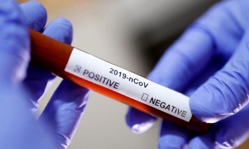 Laboratory technician holds up a Covid-19 positive sample in a vial (Reuters)