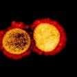 A transmission electron micrograph of SARS-CoV-2 virus particles
