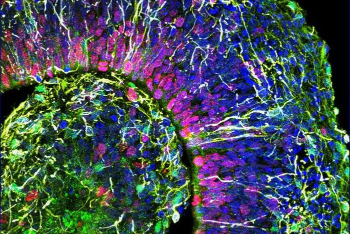 This image shows a cross-section of a brain organoid -- a lab-grown mini brain that can be used to study the effects of a disease