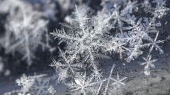 Watch Dr. P Extract A Snowflake Of A Pilar Cyst