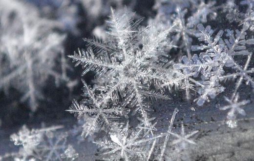 Watch Dr. P Extract A Snowflake Of A Pilar Cyst