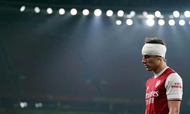Arsenal's David Luiz played on for the first half after a nasty clash of heads with Wolves' Raul Jimenez