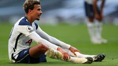 Dele Alli has played in just two of Tottenham's six matches this season