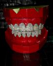 Diamond acquires new set of Gold Plated Grillz & he can’t Keep Calm (Video)