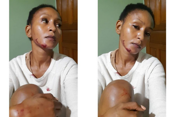 'Zora' Actress Alma and hubby involved in grisly accident [Photos]