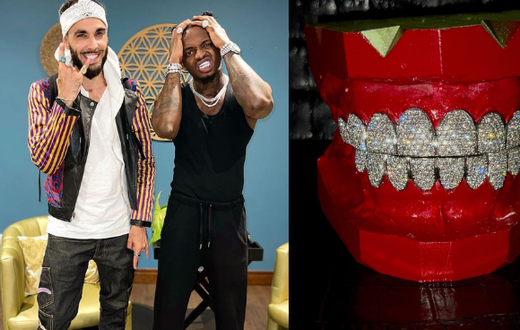 Diamond acquires a new set of Gold Plated Grillz and he can’t Keep Calm (Video)