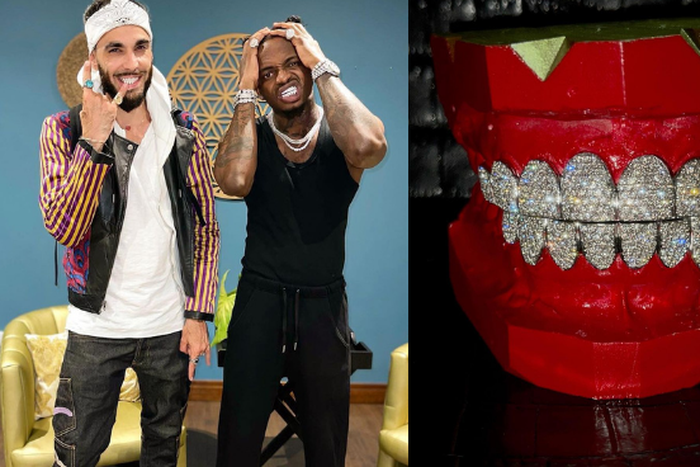 Diamond acquires a new set of Gold Plated Grillz and he can’t Keep Calm (Video)