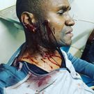 Singer Mr. Nice Survives Grisly Road Accident while headed to Nyahururu (Video)