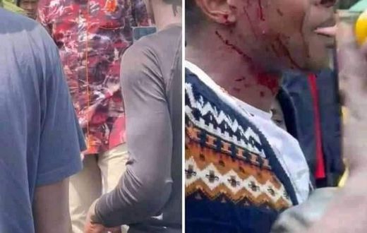 Robert Alai and Ringtone Apoko were involved in a scuffle after a minor accident