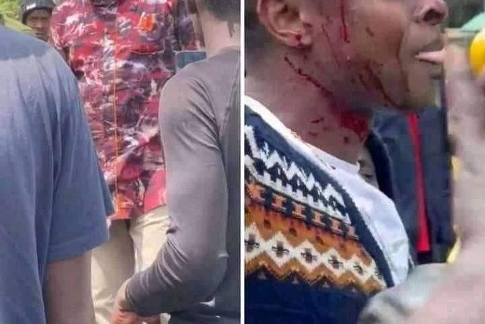 Robert Alai and Ringtone Apoko were involved in a scuffle after a minor accident