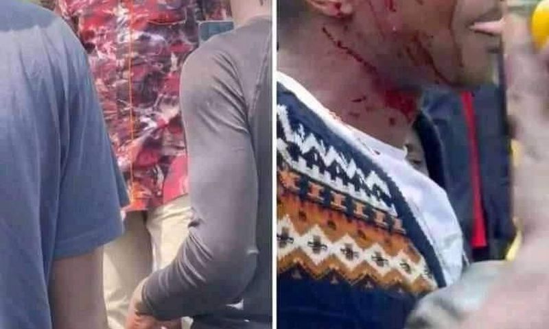Robert Alai and Ringtone Apoko were involved in a scuffle after a minor accident