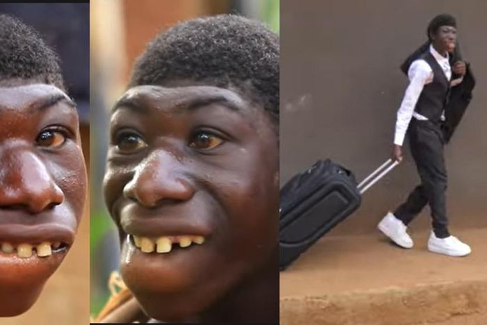 Amazing transformation of 21-year-old man bullied for being born different (video)