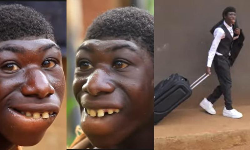 Amazing transformation of 21-year-old man bullied for being born different (video)