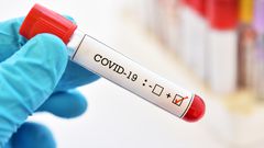 COVID-19 positive test