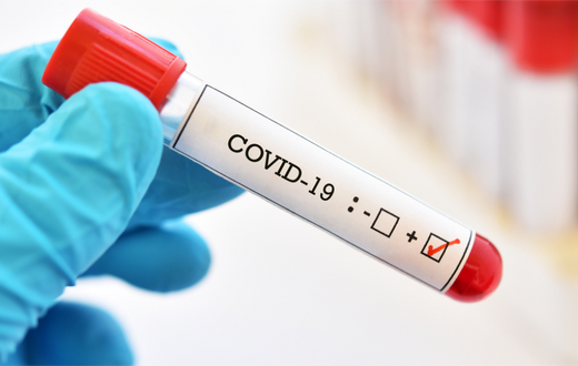 COVID-19 positive test