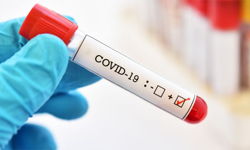 COVID-19 positive test