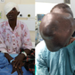 Moi Teaching & Referral Hospital removes cystic growth that covered Beatrice Makokha’s face