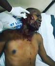 Singer Mr. Nice Survives Grisly Road Accident while headed to Nyahururu (Video)