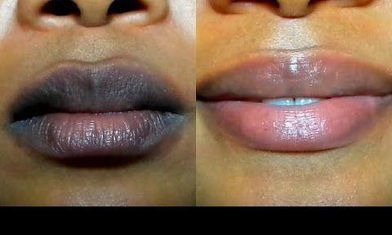 Some people will prefer lips pink [dailynigerian]