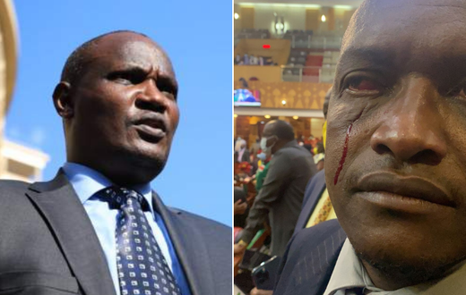 National Assembly Minority Leader John Mbadi and an injured Sigowet-Soin MP Benard Koros