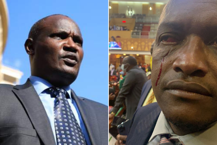 National Assembly Minority Leader John Mbadi and an injured Sigowet-Soin MP Benard Koros