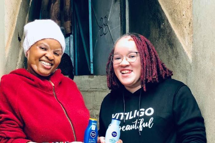 Vitiligo Ambassador Wangui Njee with Ex Machachari actress Clara Wamaitha popularly known as Cindy or Mama Stella