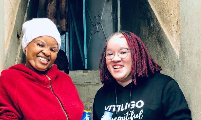 Vitiligo Ambassador Wangui Njee with Ex Machachari actress Clara Wamaitha popularly known as Cindy or Mama Stella