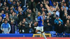 Injury setback: Everton striker Dominic Calvert-Lewin