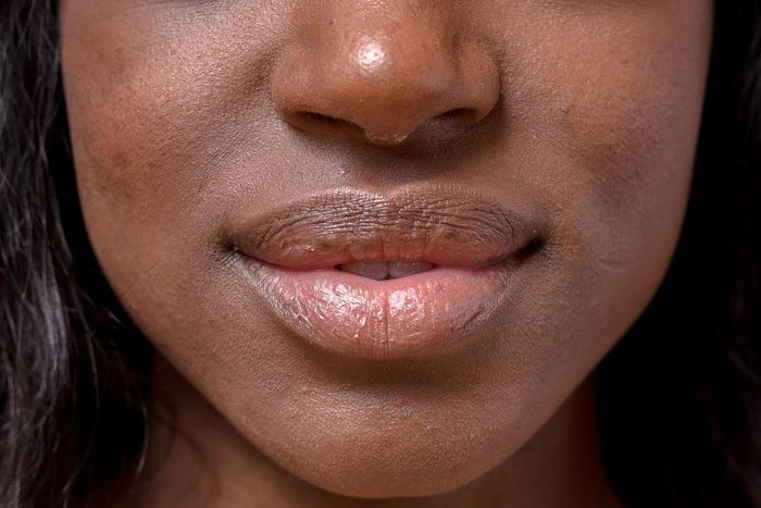 Dry lips are unattractive [self]