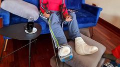 Gatundu South MP Moses Kuria at the Karen Hospital where he has been receiving treatment for severe burns