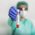 A health professional holding a test tube