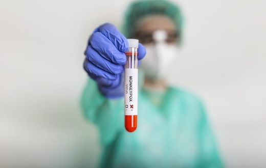 A health professional holding a test tube