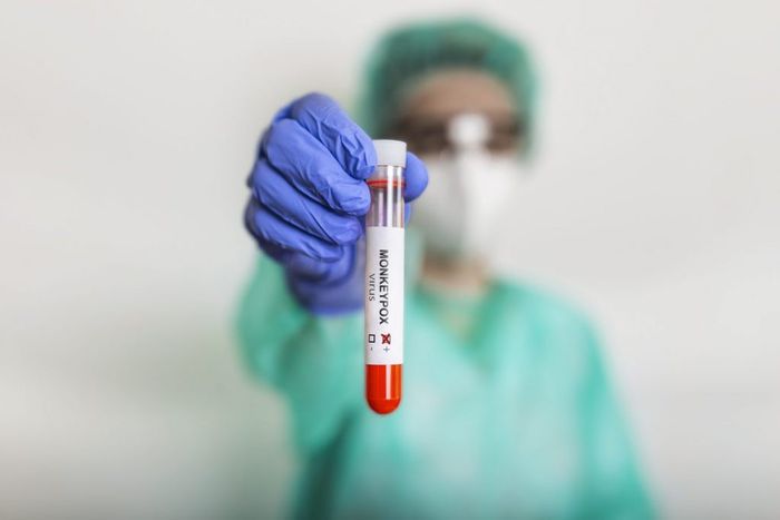 A health professional holding a test tube