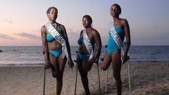 The landmine crisis in Angola is a lingering threat