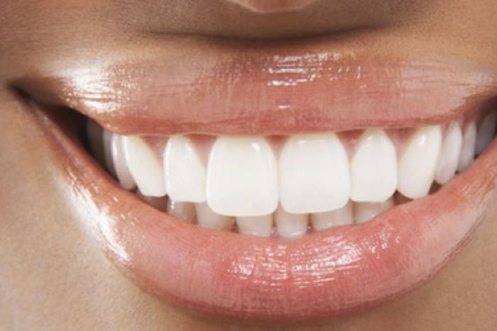 Woman with white teeth