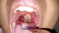 Kano State has recorded over 7,000 cases of diphtheria [Healthline]