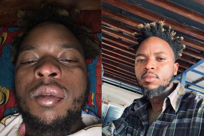 Karibu niuliwe - Magix Enga speaks after surviving scary incident