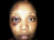 Photo of Xenah Nyambu physical abuser in 2011
