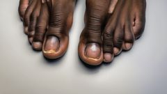 A photo of toe nails