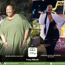 Tracy Nduati before and after 21kg weight loss with gastric balloon.