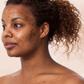 Lady with acne scars