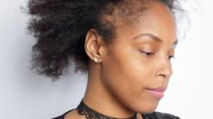 Postpartum hair loss: Causes & what to do about it