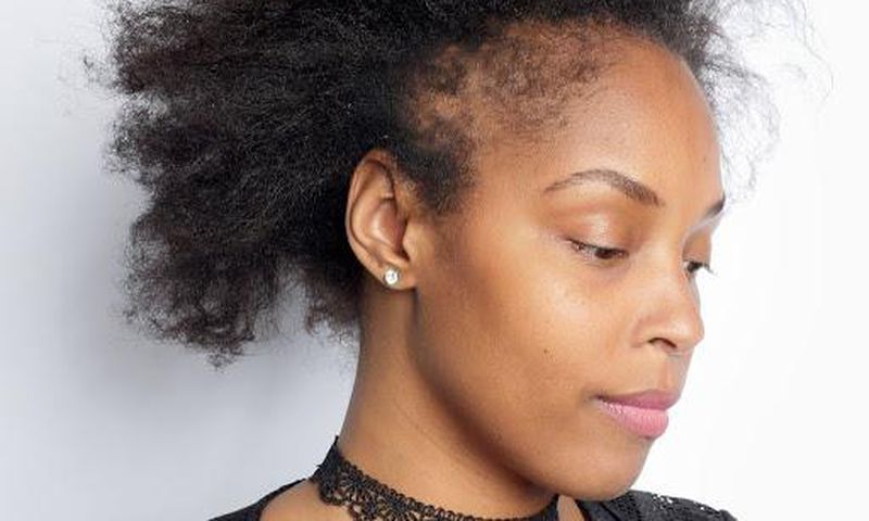 Postpartum hair loss: Causes & what to do about it