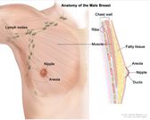 The anatomy of the male breast. The nipple and areola are shown on the outside of the breast. The lymph nodes, fatty tissue, ducts, and other parts of the inside of the breast are also shown [CDC]