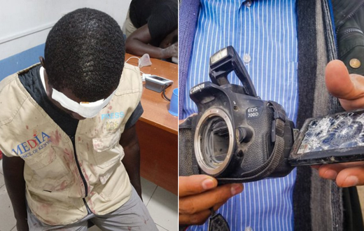 A journalist injured and a camera destroyed