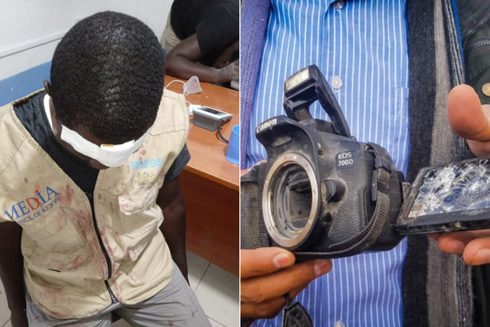 A journalist injured and a camera destroyed