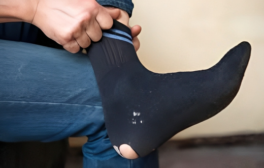 Man wearing torn socks