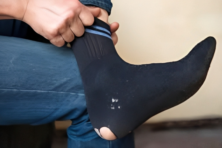 Man wearing torn socks