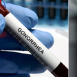Gonorrhea