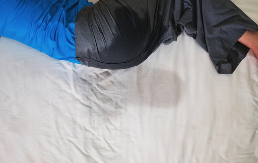 Adult bedwetting